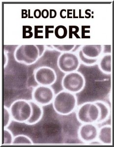 Ionic Foot Bath Scam? Absolutely not if you are using actual medical equipment. These blood cells from before the ionic foot bath help prove it!