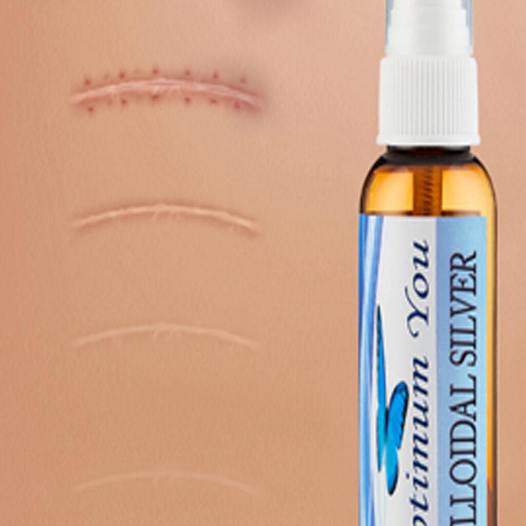 Optimum You Colloidal Silver helps wounds heal fast without scarring.