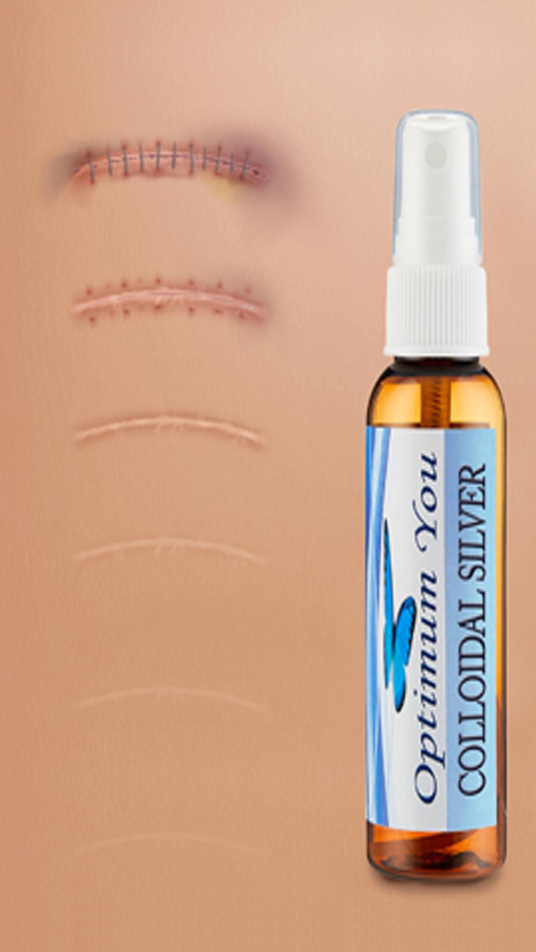 Optimum You Colloidal Silver helps wounds heal fast without scarring.