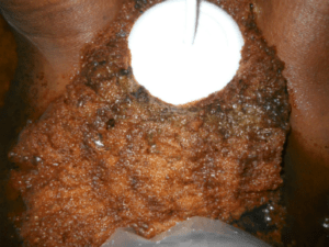 Detox Water Results _ Lymphatic Bubbly Foam