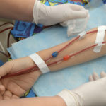 Dialysis - Blood Leaving & Entering the Arm