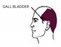 Male Pattern Baldness: Gall Bladder Issues