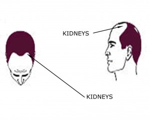 Male Pattern Baldness: Kidneys Issues