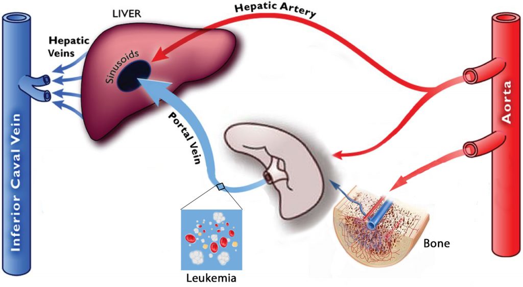 Hepatic Portal Circulation: Leukemia