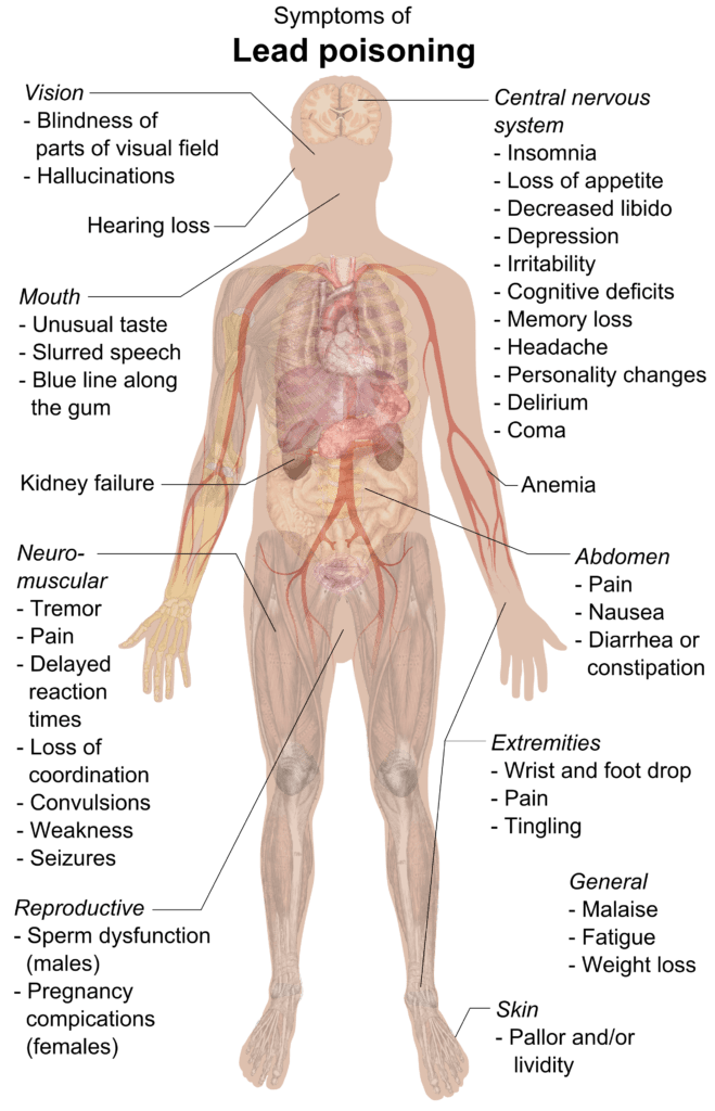 Lead Poisoning Symptoms