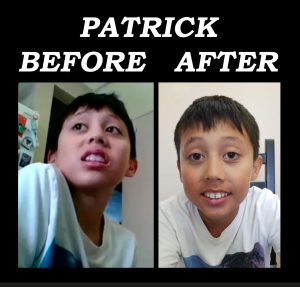Patrick, Before and After