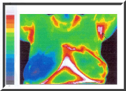 Thermal Imaging, Breast