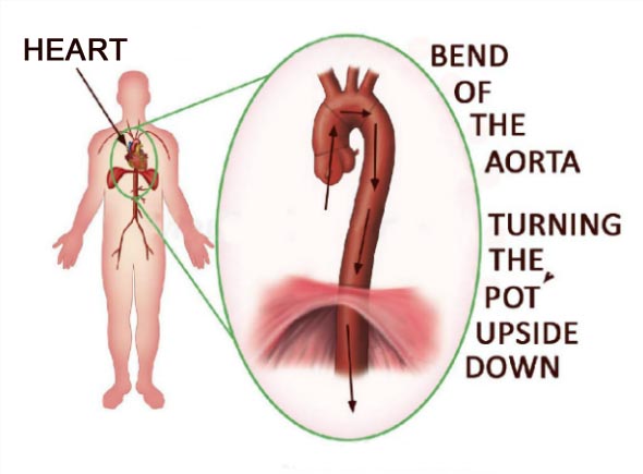 Heart, Aorta