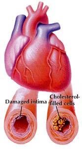 Cholesterol - Old and Sticky