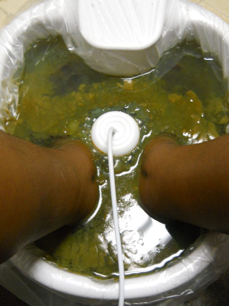 Detox Results - Kidneys and Gall Bladder