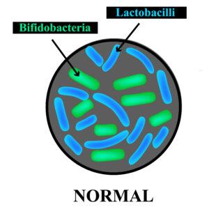 Dysbacteriosis of the intestine. Lactobacillus, Bifidobacteria, Streptococcus, Staphylococcus, E. coli, Aspergyllus mushrooms, Candida. Infographics.