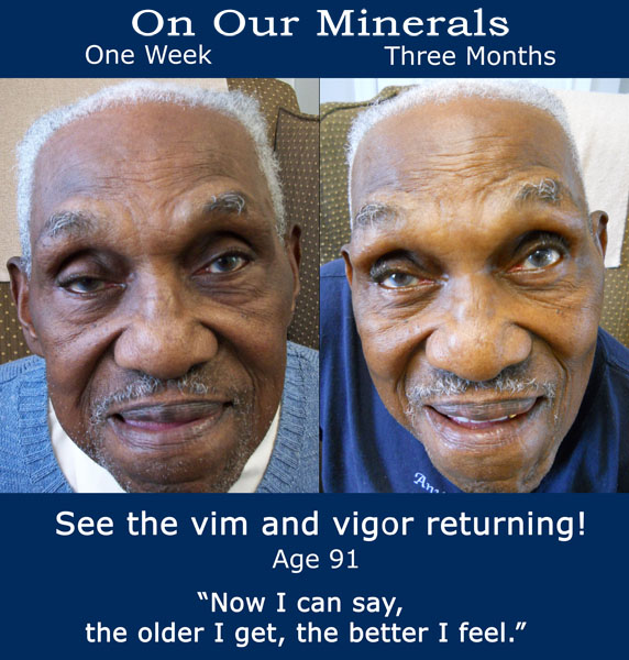 robert-b4 and after mbt minerals website