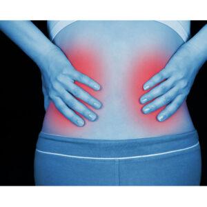 Referred Kidney Pain